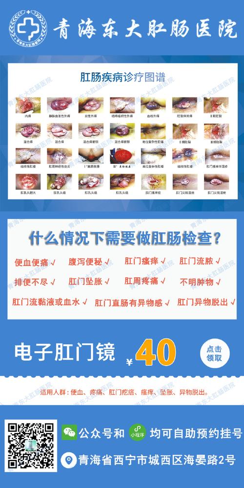 痔疮治疗医院选择