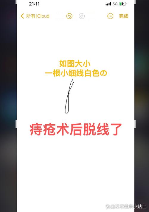 痔疮拆线