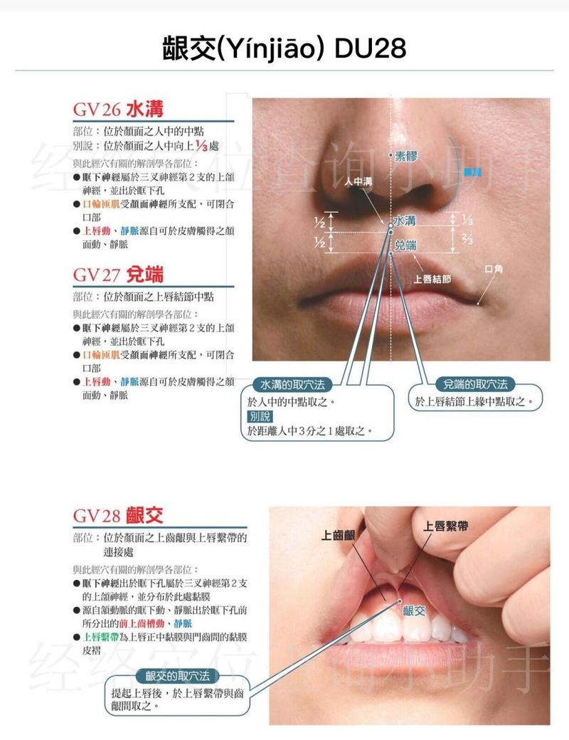 挑龈交穴疗法