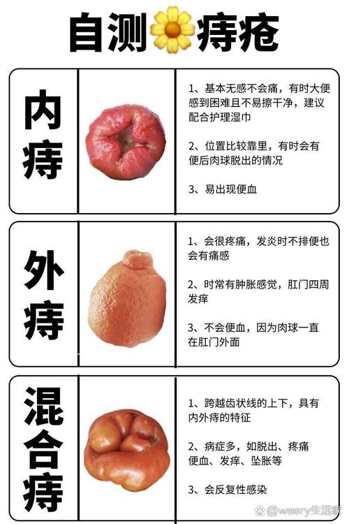 排便瘙痒感
