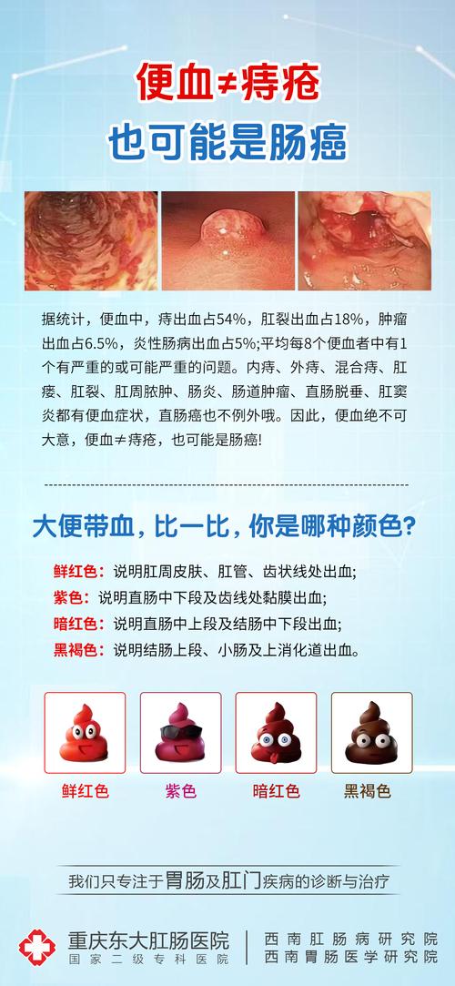 英庄镇哪里有专业治疗痔疮的医院推荐？