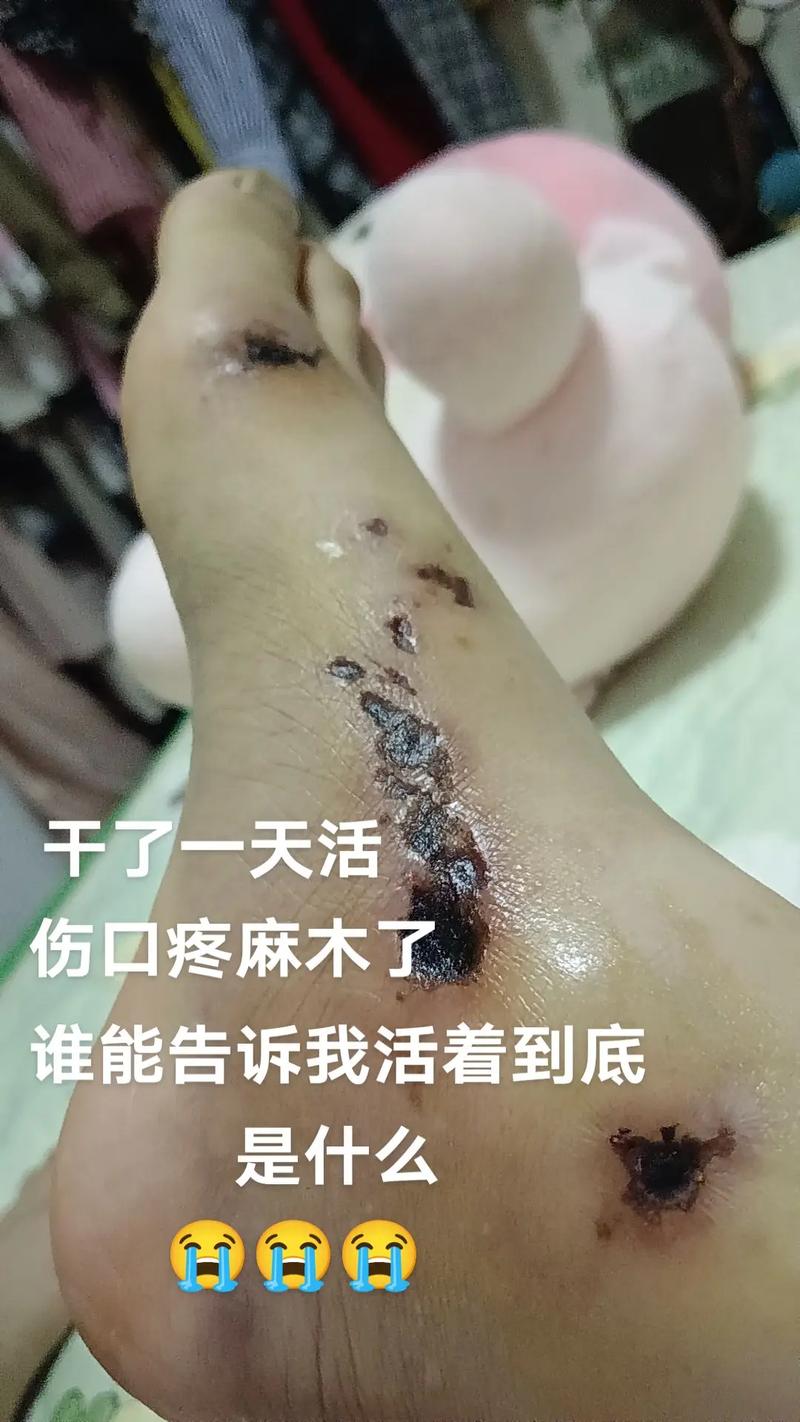 刀口疼痛