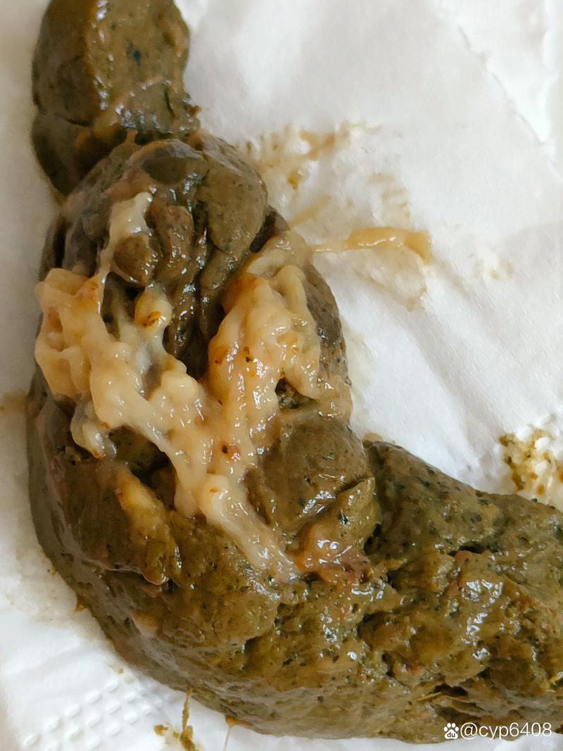 大便蜂窝状