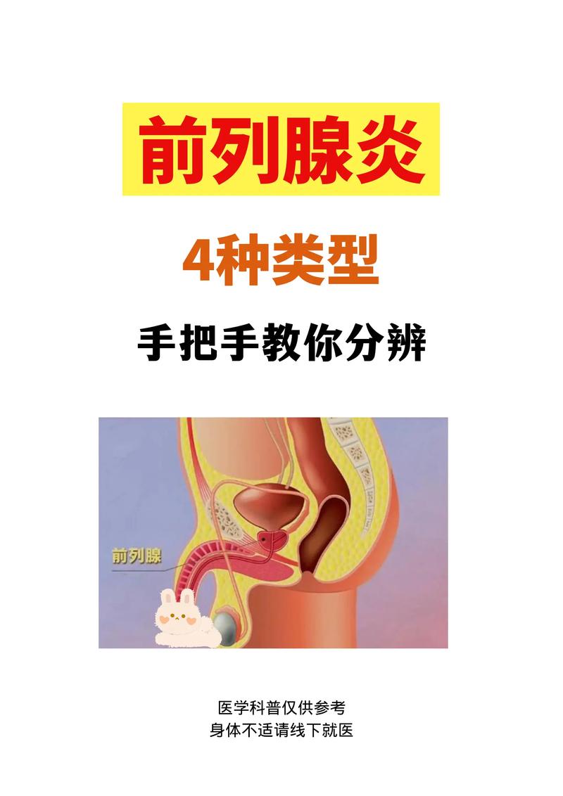 前列腺炎