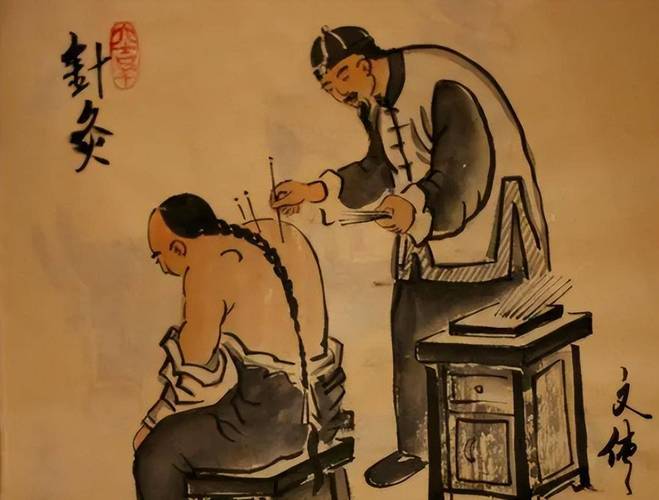 蒙古学针灸